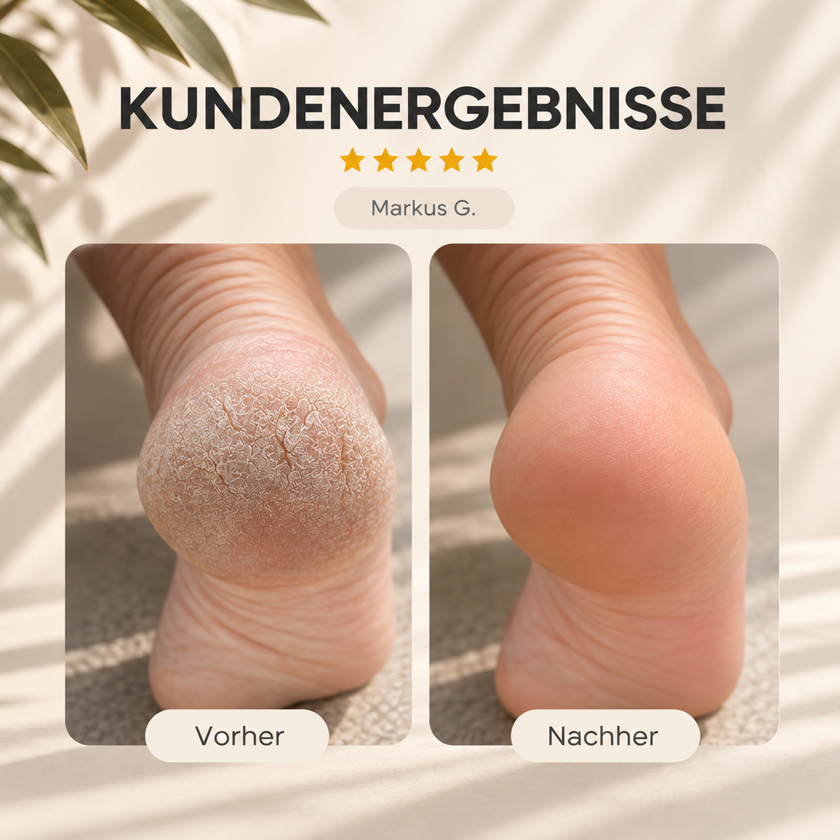 Elektrischer Hornhautentferner – Sanfte Fußpflege