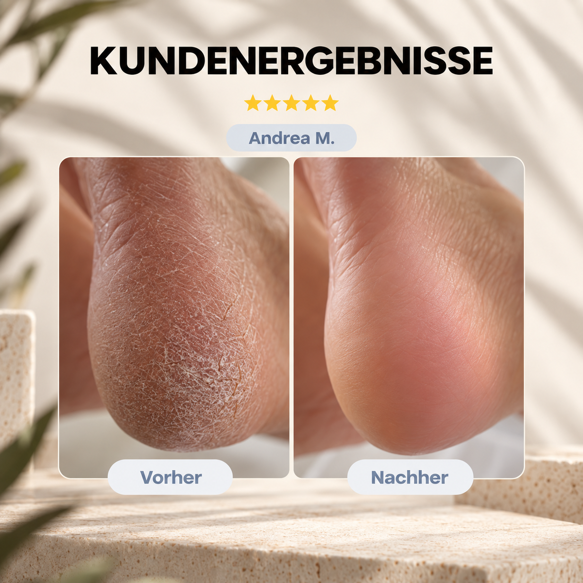 Elektrischer Hornhautentferner – Sanfte Fußpflege